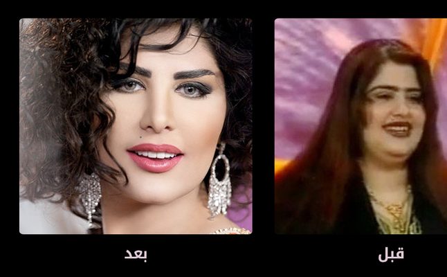 مشاهير عرب قبل وبعد عمليات التجميل المدينة نيوز