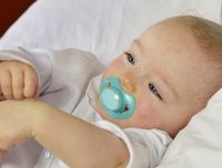معلومات عن اكزيما الرضع والفازلين 3a2ilati